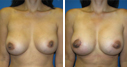 Before & After Photos